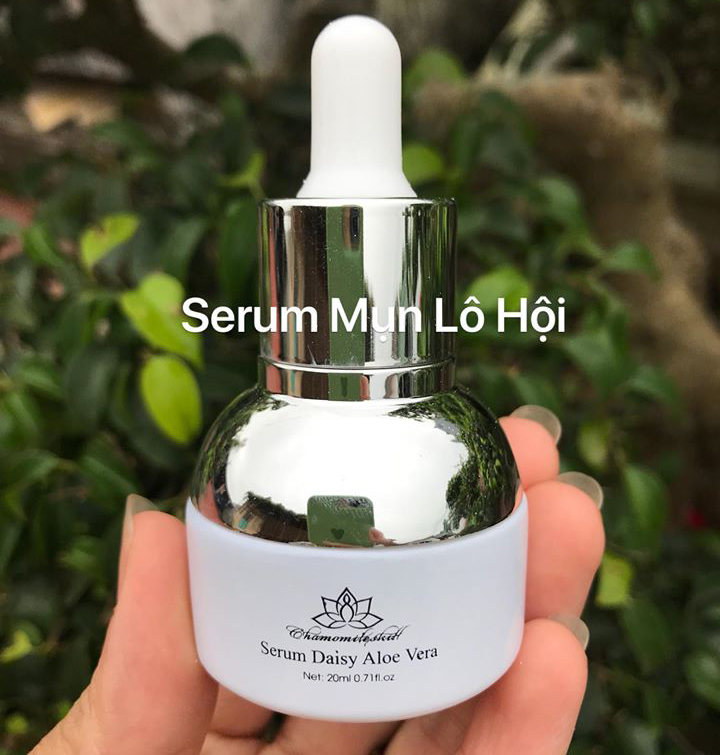 Serum lô hội cho da mụn